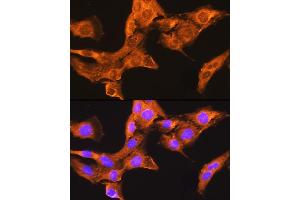 Immunofluorescence analysis of L929 cells using CDV3 Rabbit pAb (ABIN7266240) at dilution of 1:100. (CDV3 Antikörper)