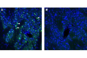 Expression of ADAM23 in rat striatum. (Adam23 Antikörper  (Extracellular))