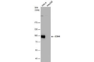 WB Image CD44 antibody detects CD44 protein by western blot analysis.