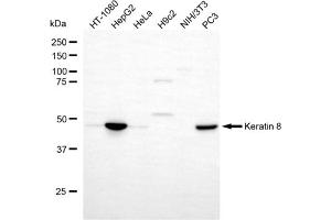 Western blotting analysis using keratin 8 antibody (ABIN7799190).