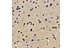 Immunohistochemical analysis of ATIC staining in rat brain formalin fixed paraffin embedded tissue section. (ATIC Antikörper)