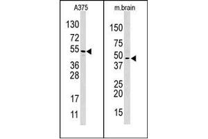 Image no. 1 for anti-Hypoxia Inducible Factor 1, alpha Subunit Inhibitor (HIF1AN) (C-Term) antibody (ABIN356560) (HIF1AN Antikörper  (C-Term))