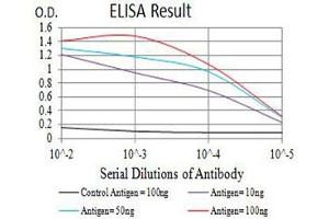 Black line: Control Antigen (100 ng),Purple line: Antigen (10 ng), Blue line: Antigen (50 ng), Red line:Antigen (100 ng) (P2RY8 Antikörper)