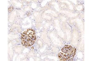 Immunohistochemistry (Paraffin-embedded Sections) (IHC (p)) image for anti-Nestin (NES) antibody (ABIN7249948)