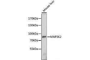 Western blot analysis of extracts of Mouse liver using MAP3K2 Polyclonal Antibody at dilution of 1:1000.