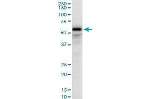 PDLIM5 polyclonal antibody (A02), Lot # NNR0051021QC01.