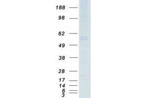 Western Blotting (WB) image for Caveolin 2 (CAV2) (Transcript Variant 1) protein (Myc-DYKDDDDK Tag) (ABIN2713245)