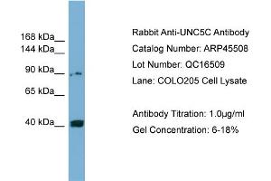 WB Suggested Anti-UNC5C  Antibody Titration: 0. (Unc5c Antikörper  (Middle Region))