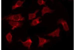ABIN6277861 staining HeLa by IF/ICC. (FADD Antikörper  (N-Term))
