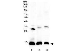 Western blot testing of 1) human placenta, 2) rat spleen and 3) mouse spleen lysate with HBD antibody at 0. (HBd Antikörper)