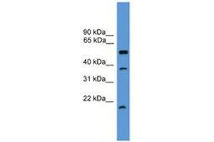Image no. 1 for anti-serine Peptidase Inhibitor, Kunitz Type, 2 (SPINT2) (AA 91-140) antibody (ABIN6746573) (SPINT2 Antikörper  (AA 91-140))