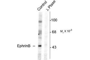 Image no. 1 for anti-Ephrin B1 (EFNB1) (pTyr331) antibody (ABIN372621) (Ephrin B1 Antikörper  (pTyr331))