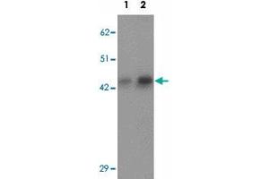 Western blot analysis of AP3M1 in human brain tissue lysate with AP3M1 polyclonal antibody  at (1) 1 and (2) 2 ug/mL. (AP3M1 Antikörper  (C-Term))