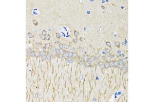 Immunohistochemistry of paraffin-embedded mouse brain using MAP1LC3B antibody. (LC3B Antikörper)
