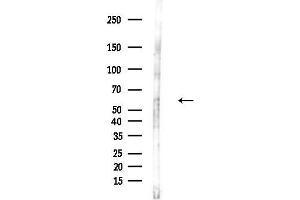 anti-Nicotinic Acetylcholine Receptor beta (CHRNB1) (N-Term) antibody