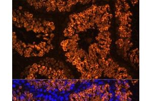 Immunofluorescence analysis of Mouse testis using LDHC Polyclonal Antibody at dilution of 1:100 (40x lens). (Lactate Dehydrogenase C Antikörper)