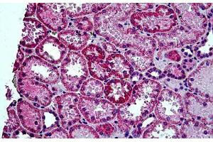 Human Kidney: Formalin-Fixed, Paraffin-Embedded (FFPE) (HYAL2 Antikörper  (AA 2-12))