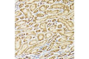 Immunohistochemistry of paraffin-embedded mouse kidney using PIK3CA Rabbit pAb (ABIN6134411, ABIN6145635, ABIN6145637 and ABIN6216129) at dilution of 1:150 (40x lens). (PIK3CA Antikörper)