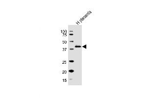 Western Blot at 1:1000 dilution + human placenta lysate Lysates/proteins at 20 ug per lane. (HSD3B1 Antikörper  (N-Term))