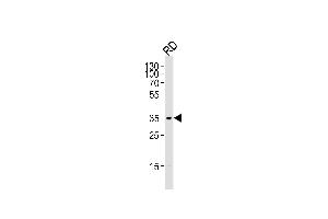Western blot analysis of lysate from RD cell line,using Cyclin D2 Antibody (Ab-280)(ABIN1450707 and ABIN1450709).