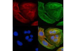 ABIN6257474 and ABIN6276211 staining Hela cells(30 min of UV treatment) by IF/ICC.