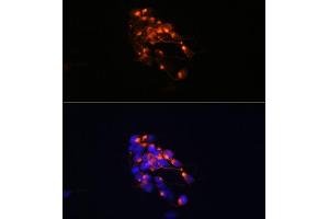 Immunofluorescence analysis of SH-SY5Y cells using Neurofilament M Rabbit mAb (ABIN7268864) at dilution of 1:100 (40x lens). (NEFM Antikörper)