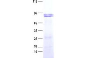 Validation with Western Blot (SMAD5 Protein (His tag))