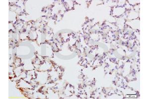 Formalin-fixed and paraffin embedded rat lung tissue labeled with Anti-PAX9 Polyclonal Antibody, Unconjugated (ABIN737691) at 1:200 followed by conjugation to the secondary antibody and DAB staining (PAX9 Antikörper  (AA 271-341))