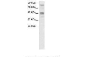 Image no. 1 for anti-SRY (Sex Determining Region Y)-Box 18 (SOX18) (AA 192-241) antibody (ABIN202394) (SOX18 Antikörper  (AA 192-241))