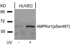 Western blot analysis of extracts from HUVEC cells untreated or treated with UV using AMPKa1(Phospho-Ser487)Antibody. (AMPK alpha Antikörper  (pSer487))