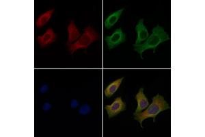 ABIN6265957 and ABIN6269022 staining Hela cells by IF/ICC.