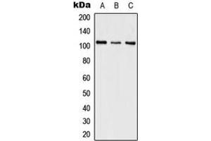 Western blot analysis of SWAP expression in HeLa (A), SP2/0 (B), PC12 (C) whole cell lysates. (SFRS8 Antikörper  (Center))