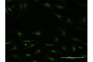 Immunofluorescence (IF) image for anti-Lysine (K)-Specific Demethylase 6A (KDM6A) (AA 641-740) antibody (ABIN948618)
