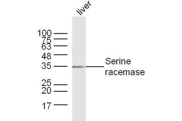 SRR 抗体  (AA 1-100)