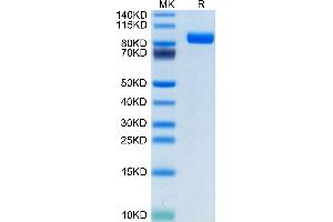 Human SEMA4B on Tris-Bis PAGE under reduced condition. (SEMA4B Protein (AA 44-717) (His tag))