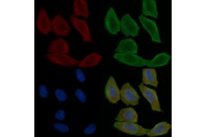 ABIN6260383 and ABIN6279247 staining Hela cells(30 min of UV treatment) by IF/ICC. (CA8 Antikörper  (C-Term))