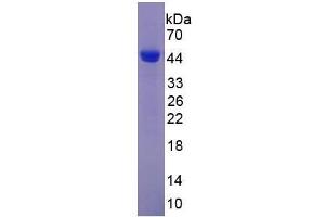 Image no. 2 for Glutamic-Oxaloacetic Transaminase 1, Soluble (Aspartate Aminotransferase 1) (GOT1) (AA 2-413) protein (His tag) (ABIN1879343) (GOT1 Protein (AA 2-413) (His tag))