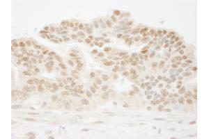 Immunohistochemistry (IHC) image for anti-Cleavage Stimulation Factor, 3' Pre-RNA, Subunit 1, 50kDa (CSTF1) (AA 75-125) antibody (ABIN7448496)