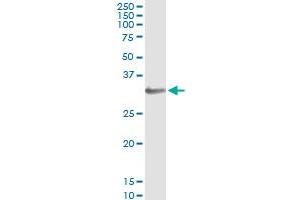 Immunoprecipitation of HOXB1 transfected lysate using anti-HOXB1 monoclonal antibody and Protein A Magnetic Bead , and immunoblotted with HOXB1 MaxPab rabbit polyclonal antibody. (HOXB1 Antikörper  (AA 101-210))