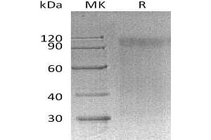 Western Blotting (WB) image for Signal-Regulatory Protein alpha (SIRPA) protein (ABIN7320648) (SIRPA Protein)
