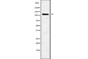 Western blot analysis of APOB48R using HUVEC whole cell lysates (APOBR Antikörper  (C-Term))