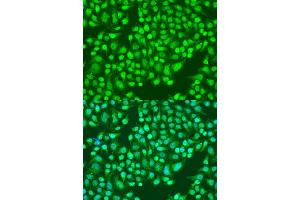 Immunofluorescence analysis of U2OS cells using ITGA2 antibody. (ITGA2 Antikörper)