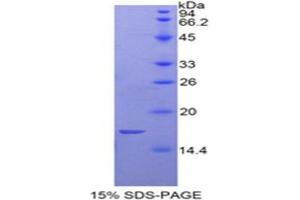 SDS-PAGE analysis of Rat GP1Bb Protein. (Glycoprotein Ib (Platelet), beta Polypeptide (GP1BB) Peptid)