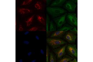 ABIN6259707 and ABIN6276744 staining  cells by IF/ICC. (ABO Antikörper  (N-Term))