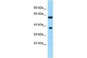 Host: Rabbit Target Name: Ndufa10l1 Sample Type: Rat Pancreas lysates Antibody Dilution: 1. (NDUFA10L1 Antikörper  (C-Term))