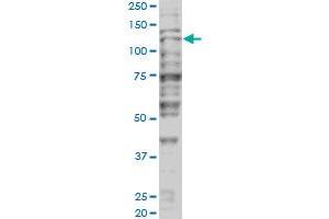 Western Blotting (WB) image for anti-Tripartite Motif Containing 24 (TRIM24) (AA 432-569) antibody (ABIN599067) (TRIM24 Antikörper  (AA 432-569))