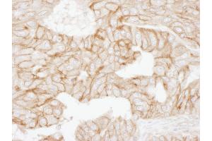 Immunohistochemistry (IHC) image for anti-Adducin 1 (Alpha) (ADD1) (AA 632-682) antibody (ABIN7454952) (alpha Adducin Antikörper  (AA 632-682))