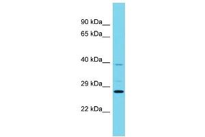 Host: Rabbit Target Name: RABL6 Sample Type: Jurkat Whole Cell lysates Antibody Dilution: 1. (C9orf86 Antikörper  (N-Term))