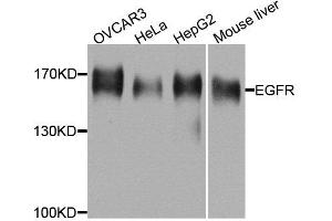 Western blot analysis of extracts of various cell lines, using EGFR antibody. (EGFR Antikörper  (AA 1021-1210))