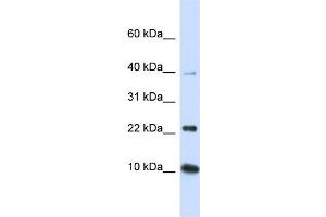 WB Suggested Anti-UBE2D2 Antibody Titration:  0. (UBE2D2 Antikörper  (N-Term))